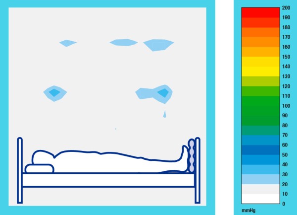 All Up – Foot Sole