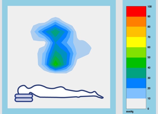 All Up – Head Intubate DUO White