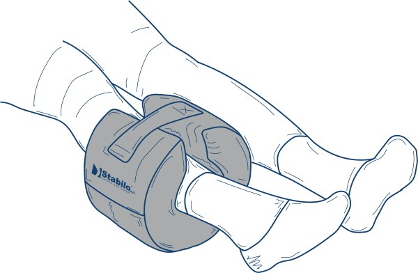 StabiloBed® Universal Abduktionsring