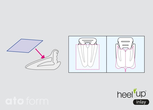 Heel Up - Inlay x 10