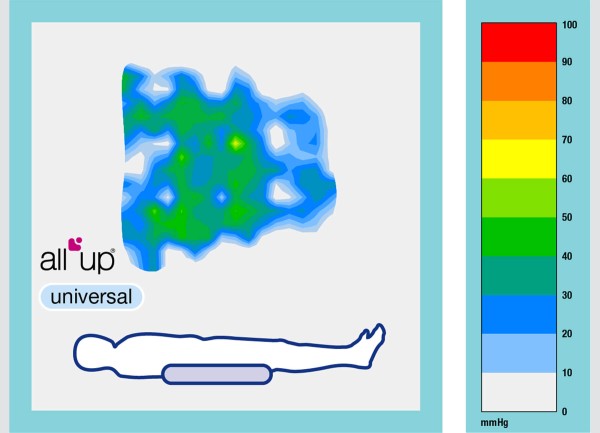 All Up – Universal