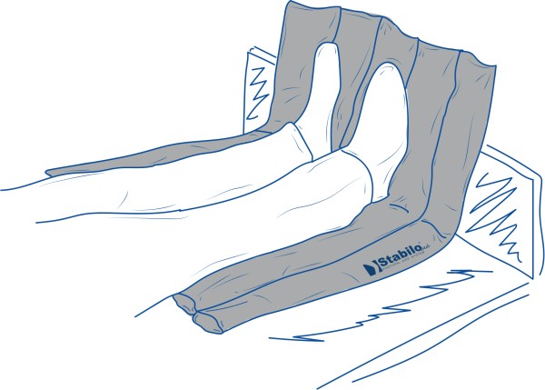 StabiloBed® Positionierungskissen für untere Gliedmaßen