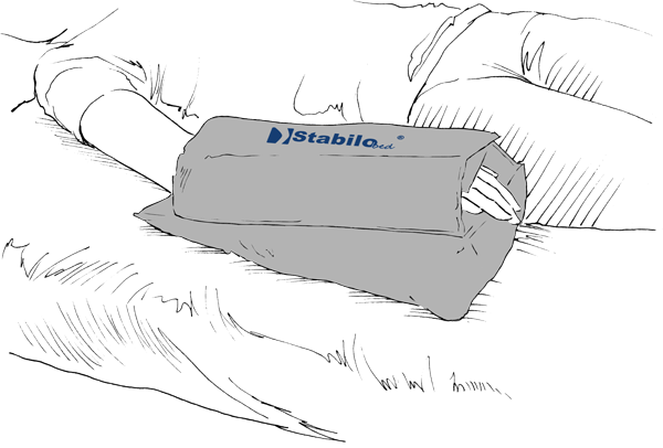 StabiloBed® Unterarmstabilisierung mit Sicherung
