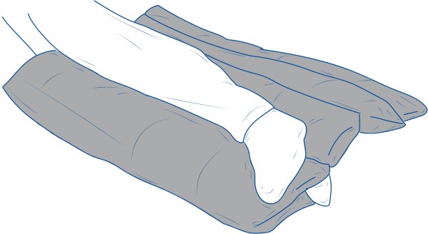 StabiloBed® Positionierungskissen für untere Gliedmaßen