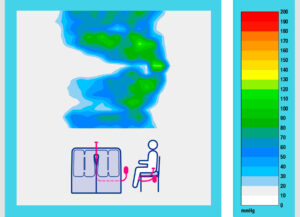 Seat All Flexi Druckbild