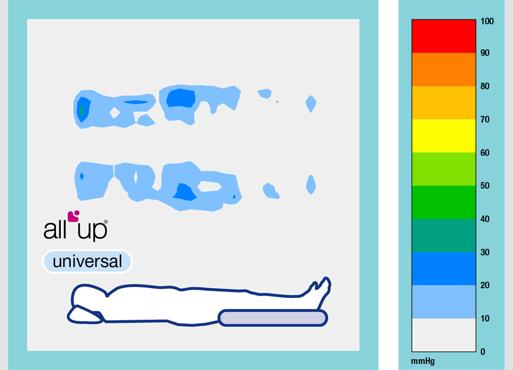 All Up Universal Grafik Druckbild