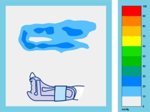 Heel Up Fix Long Grafik