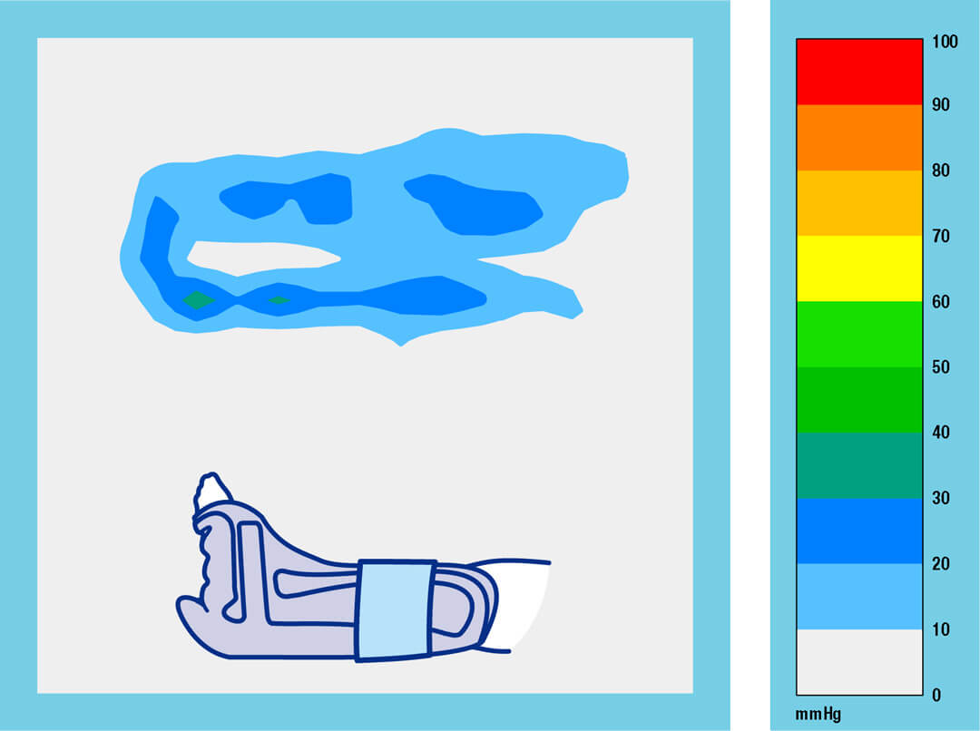 Heel Up Fix Long Grafik