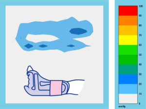 Heel Up Fix Medium Grafik