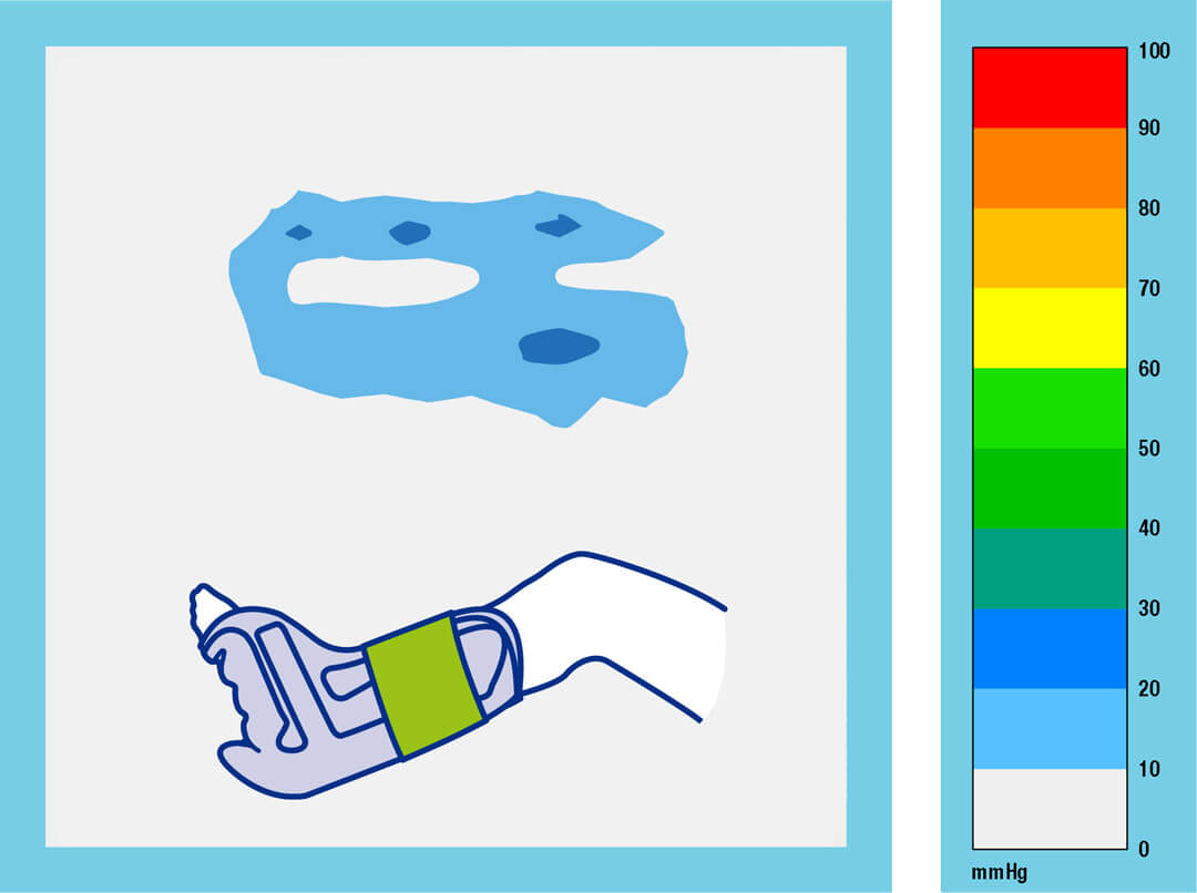 Heel Up Fix Short Grafik