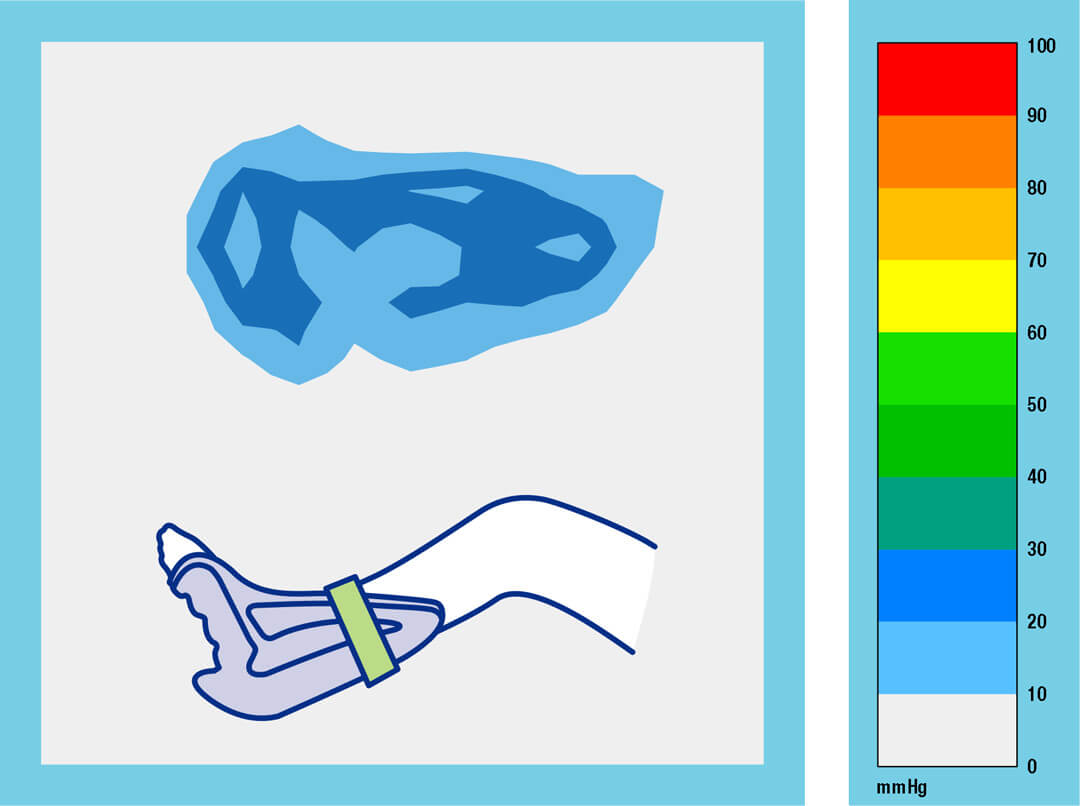 Heel Up Short Grafik Druckbild