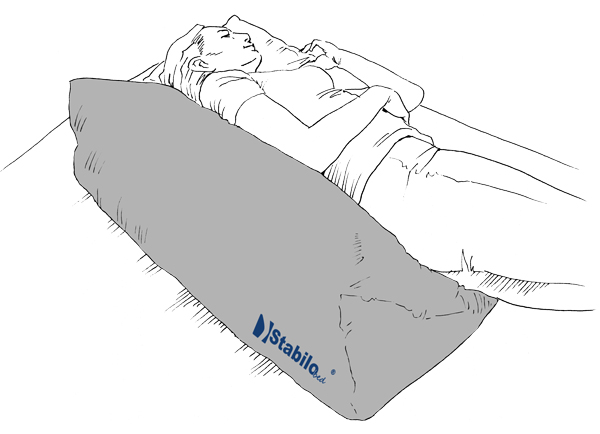 Anwendung Lateral Positionierungskeil