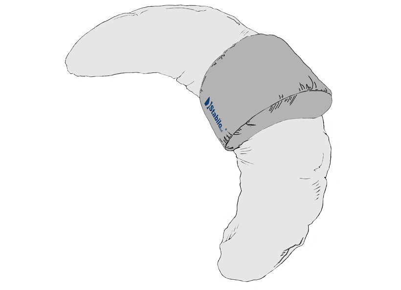 Anwendung StabiloBed Thermoaktivkopfkissen