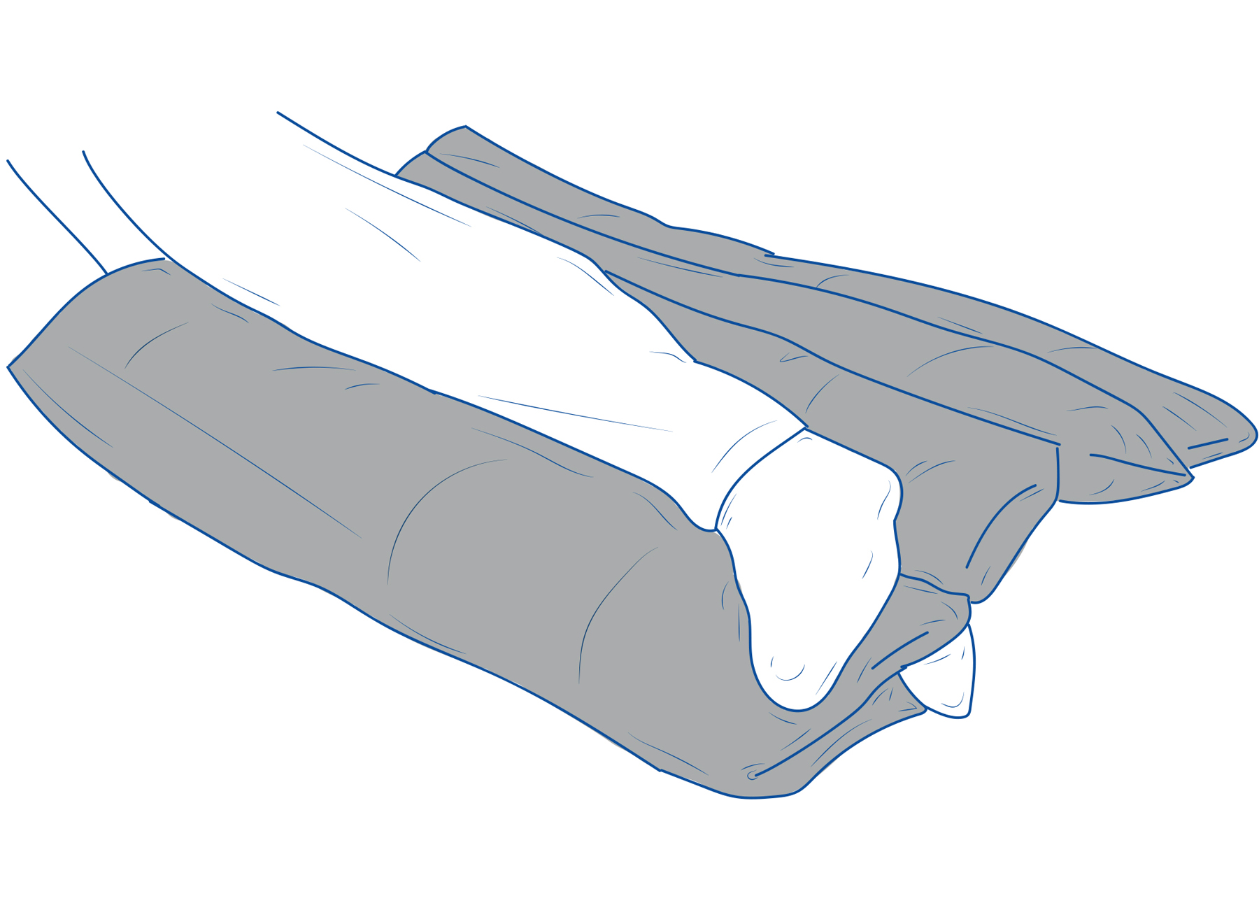 Anwendung Positionierungskissen für untere Gliedmaßen