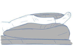 Anwendung Beinkissen mit Abduktionskeil